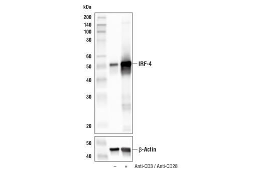 Western Blotting Image 4: IRF-4 (E8H3S) XP<sup>®</sup> Rabbit mAb (BSA and Azide Free)