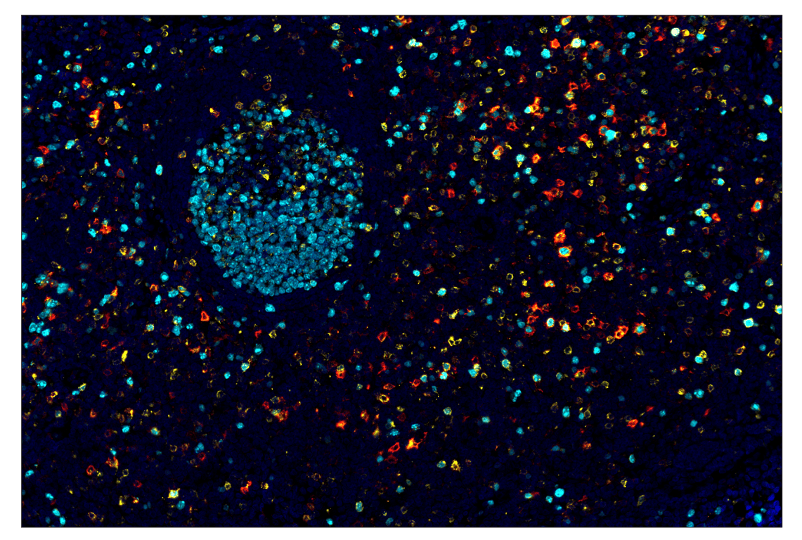 Immunohistochemistry Image 1: CTLA-4 (E2V1Z) & CO-0078-594 SignalStar<sup>™</sup> Oligo-Antibody Pair