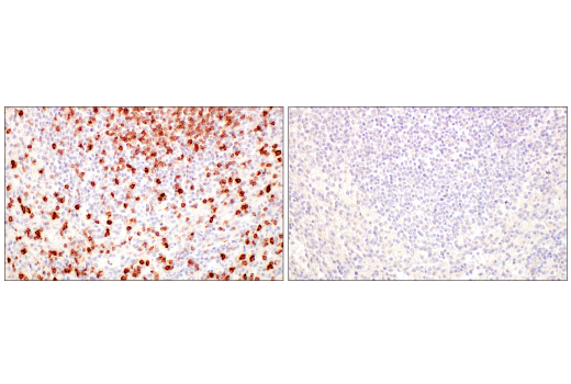 Immunohistochemistry Image 9: CD7 (E4G1Q) XP<sup>®</sup> Rabbit mAb