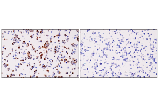 Immunohistochemistry Image 7: Cyclin D1 (E3P5S) XP<sup>®</sup> Rabbit mAb (BSA and Azide Free)