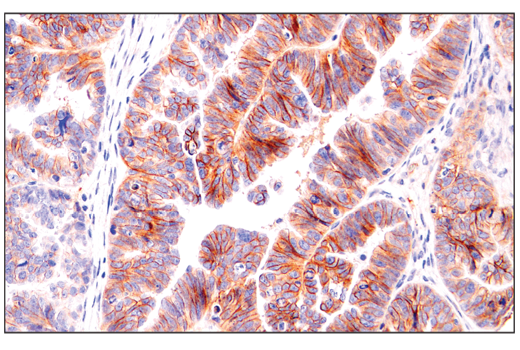 Immunohistochemistry Image 1: Semaphorin-4D/CD100 (E5C3B) XP<sup>®</sup> Rabbit mAb