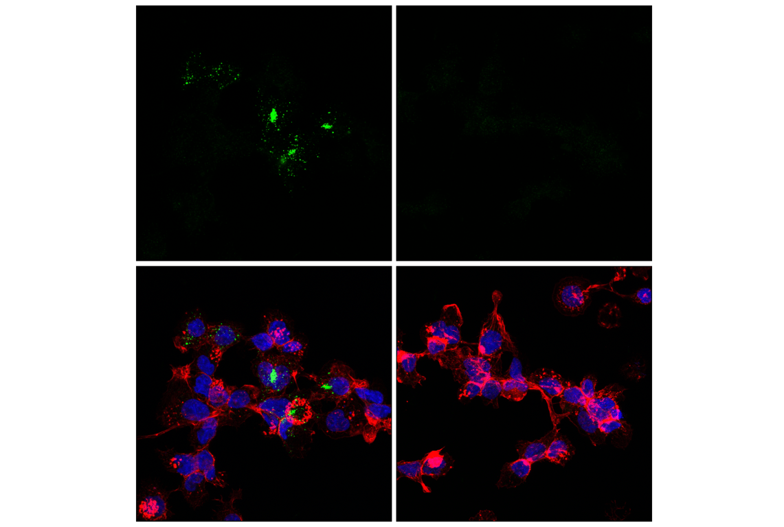 Immunofluorescence Image 1: Phospho-STING (Ser366) (D8K6H) Rabbit mAb