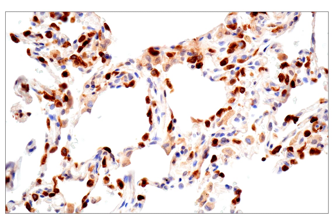 Immunohistochemistry Image 8: ACBP/DBI (E4V8V) XP<sup>®</sup> Rabbit mAb