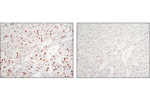 Immunohistochemistry Image 3: C/EBPα (D56F10) XP<sup>®</sup> Rabbit mAb (BSA and Azide Free)