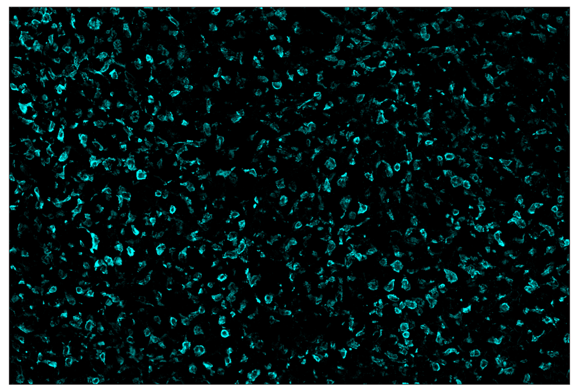 Immunohistochemistry Image 5: CD206/MRC1 (E6T5J) & CO-0032-647 SignalStar<sup>™</sup> Oligo-Antibody Pair