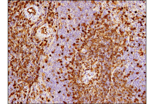 Immunohistochemistry Image 5: ASS1 (D4O4B) XP<sup>®</sup> Rabbit mAb