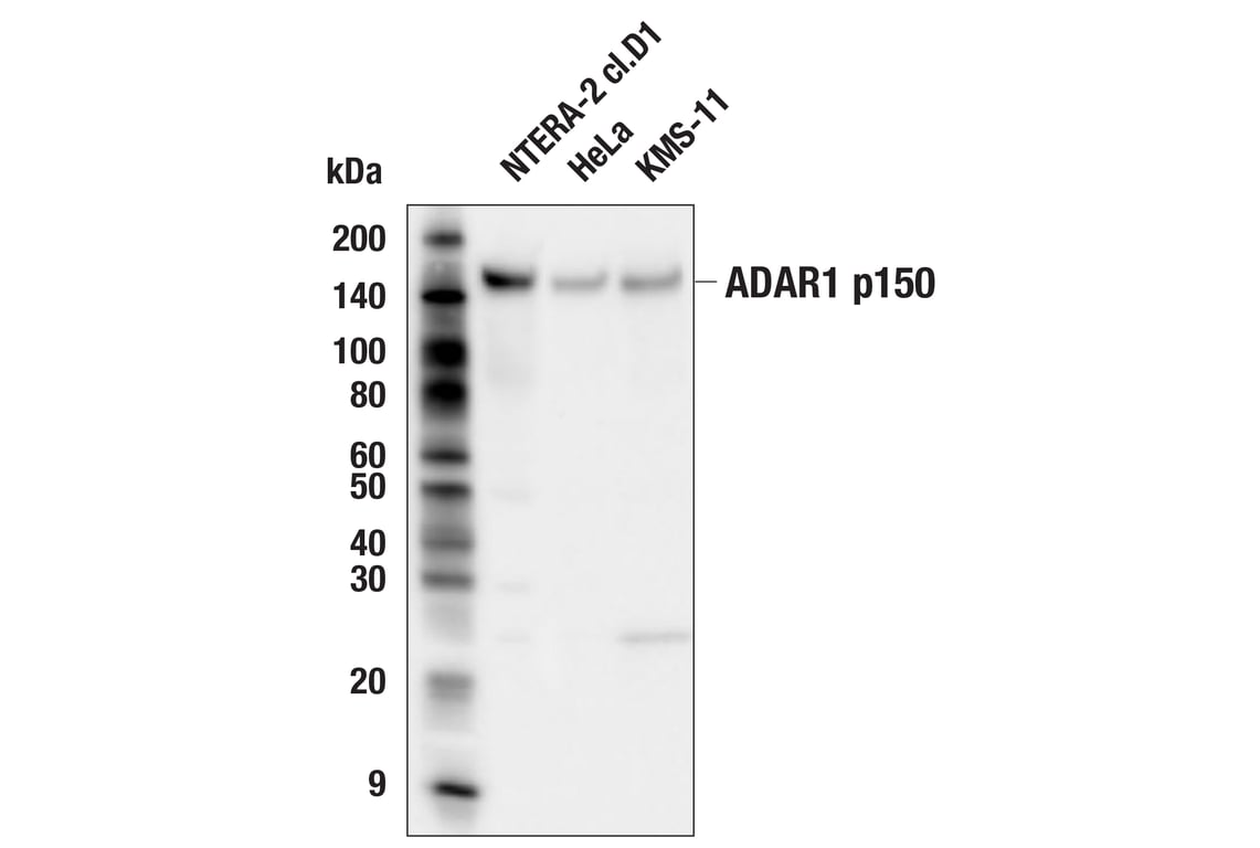 Western Blotting Image 3: ADAR1 p150 Isoform   (E6U1U) Rabbit mAb   (BSA and Azide Free)