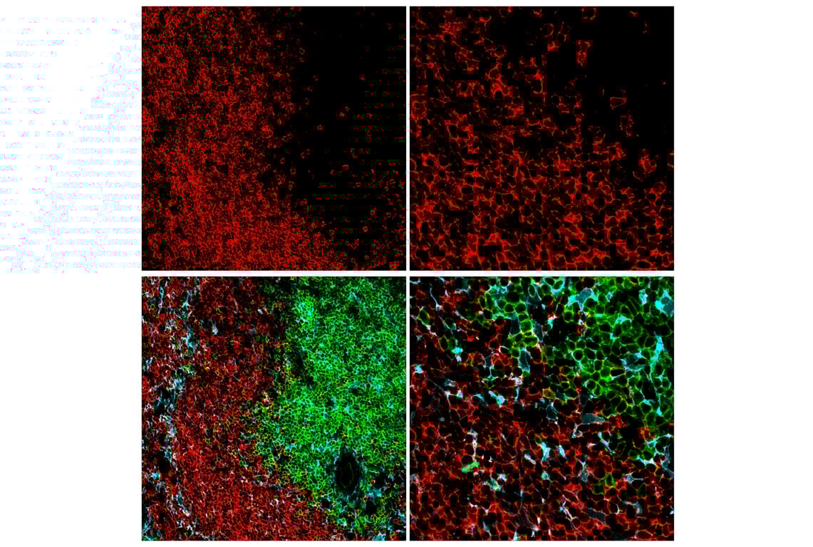 Immunofluorescence Image 2: CD20 (E3N7O) XP<sup>®</sup> Rabbit mAb