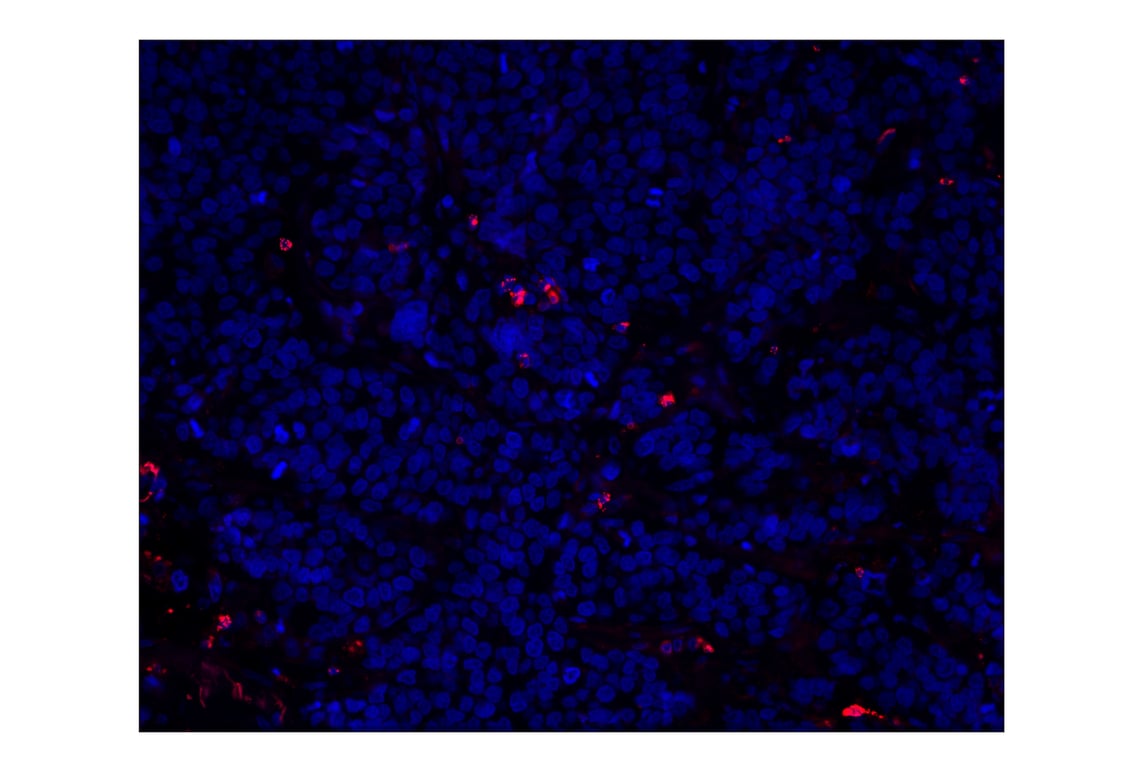 Immunohistochemistry Image 1: Granzyme B (D6E9W) Rabbit mAb (Alexa Fluor<sup>®</sup> 555 Conjugate)