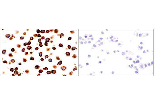 Immunohistochemistry Image 3: NG2/CSPG4 (E3B3G) XP<sup>®</sup> Rabbit mAb (BSA and Azide Free)