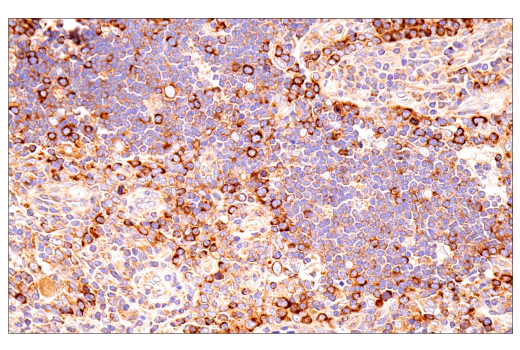 Immunohistochemistry Image 8: G3BP1 (E9G1M) XP<sup>®</sup> Rabbit mAb