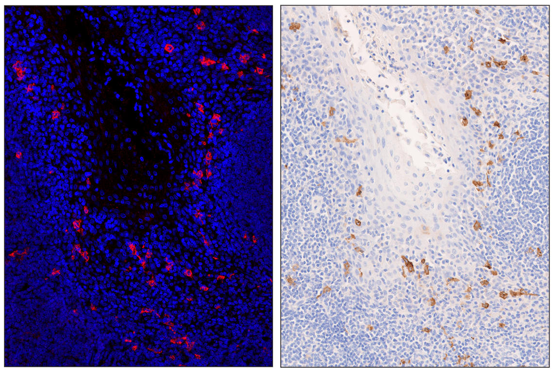 Immunohistochemistry Image 5: XCR1 (D2F8T) & CO-0015-594 SignalStar<sup>™</sup> Oligo-Antibody Pair