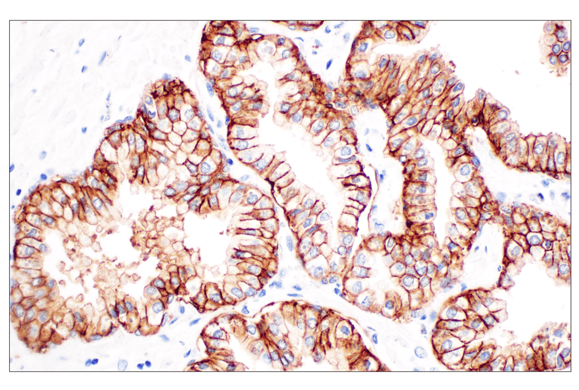 Immunohistochemistry Image 3: TACSTD2/TROP2 (F4W4J) Rabbit mAb (BSA and Azide Free)