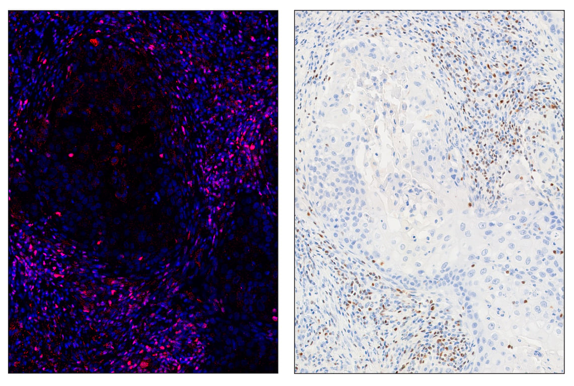 Immunohistochemistry Image 6: Tox/Tox2 (E6I3Q) & CO-0016-750 SignalStar<sup>™</sup> Oligo-Antibody Pair