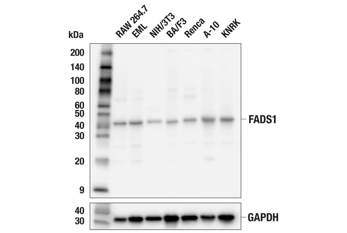 Western Blotting Image 2: FADS1 (F1D2A) Rabbit mAb