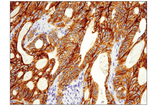 Immunohistochemistry Image 1: Met (D1C2) XP<sup>®</sup> Rabbit mAb (BSA and Azide Free)