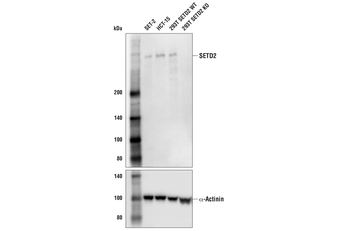 Western Blotting Image 1: SETD2 (E9H7P) Rabbit mAb