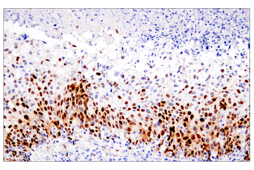 Immunohistochemistry Image 2: Cyclin D1 (E3P5S) XP<sup>®</sup> Rabbit mAb (BSA and Azide Free)