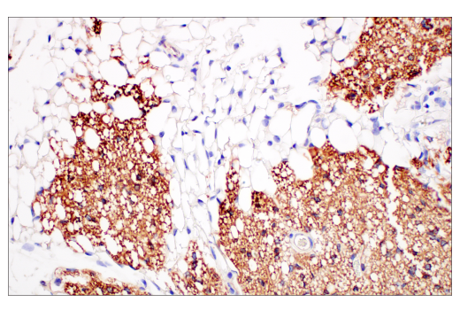 Immunohistochemistry Image 4: UCP1 (E9Z2V) XP<sup>®</sup> Rabbit mAb (BSA and Azide Free)