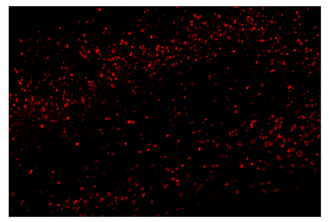 Immunohistochemistry Image 4: Ki-67 (D3B5) & CO-0052-647 SignalStar<sup>™</sup> Oligo-Antibody Pair