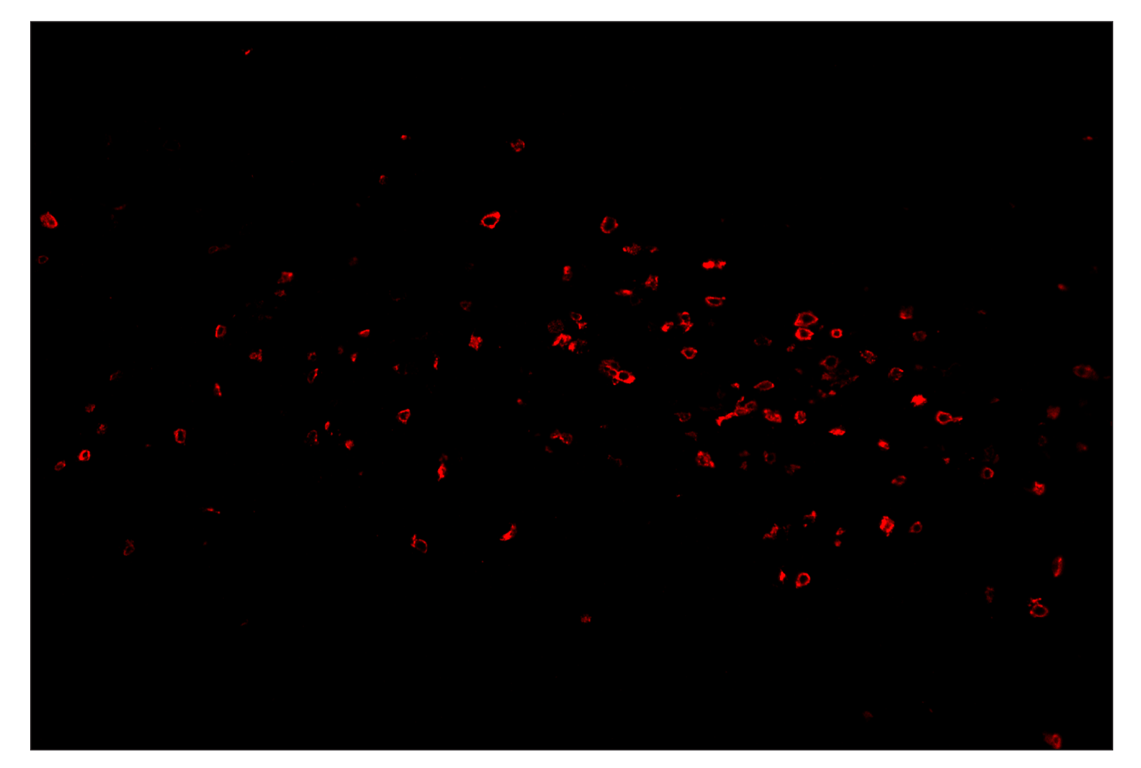 Immunohistochemistry Image 4: CD8α (D4W2Z) & CO-0040-488 SignalStar<sup>™</sup> Oligo-Antibody Pair