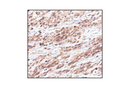 undefined Image 7: PhosphoPlus<sup>®</sup> IκBα (Ser32/Ser36) Antibody Duet