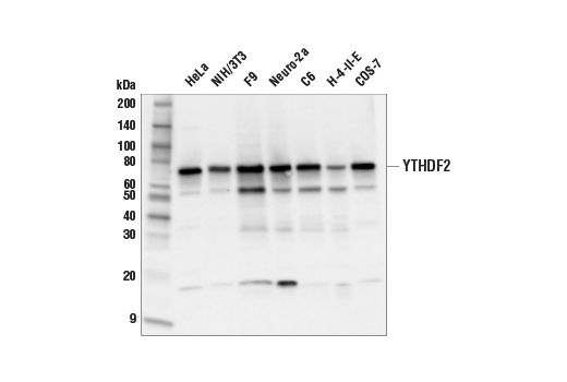 Western Blotting Image 2: YTHDF2 (E2I2H) Rabbit mAb