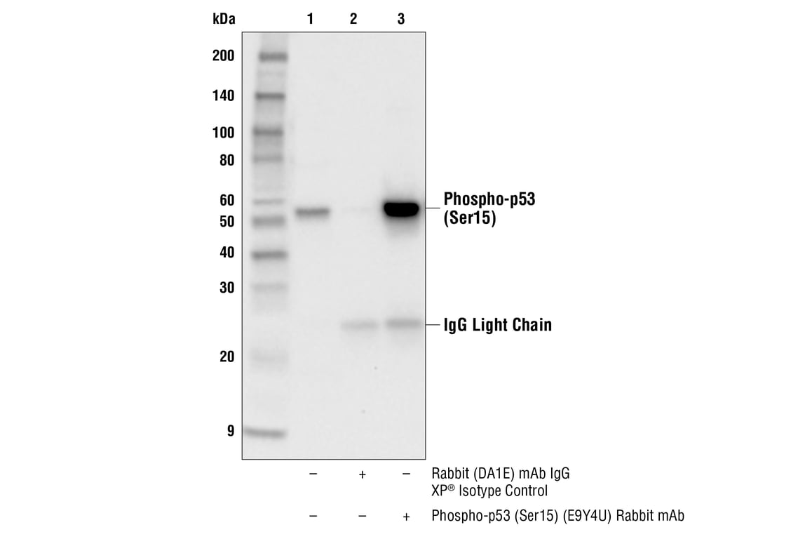 undefined Image 5: PhosphoPlus<sup>®</sup> p53 (Ser15) Antibody Duet