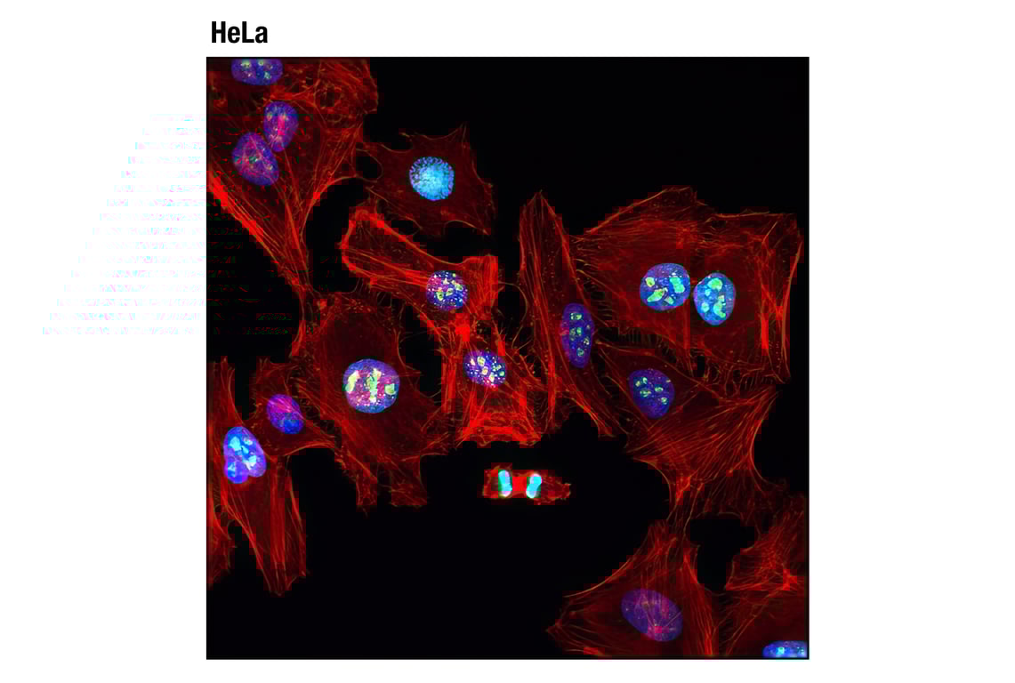 Immunofluorescence Image 1: Ki-67 (8D5) Mouse mAb