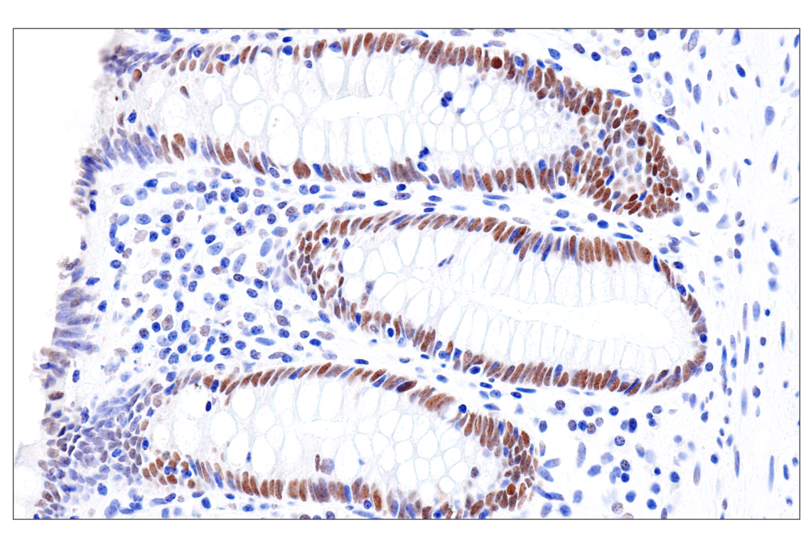 Immunohistochemistry Image 14: FoxA1/HNF3α (IHC578) Mouse mAb
