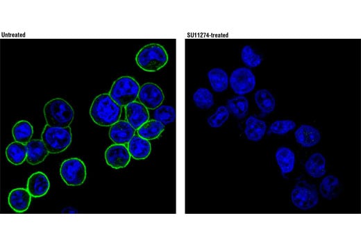 Immunofluorescence Image 1: Phospho-Met (Tyr1234/1235) (D26) XP<sup>®</sup> Rabbit mAb (BSA and Azide Free)