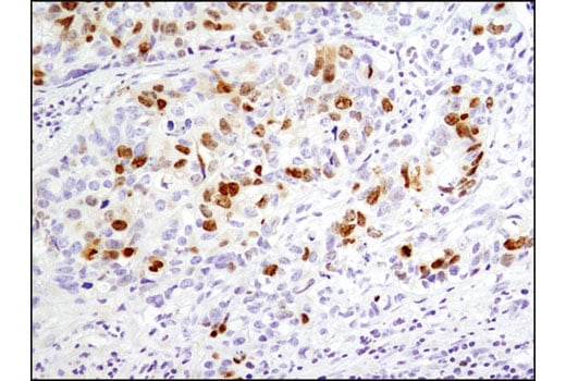 Immunohistochemistry Image 2: Topoisomerase IIα (D10G9) XP<sup>®</sup> Rabbit mAb