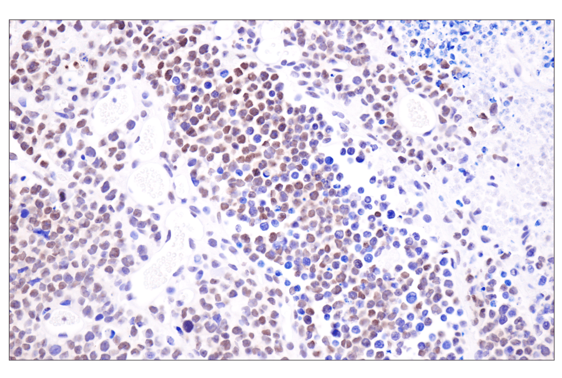 Immunohistochemistry Image 9: Acetyl-Histone H4 (Lys16) (E2B8W) Rabbit mAb