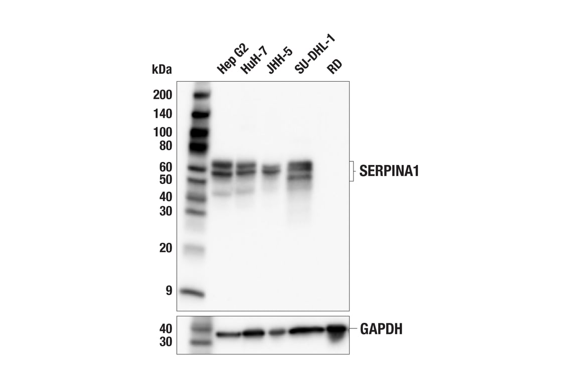 SERPINA1 (F6I2Z) Rabbit mAb