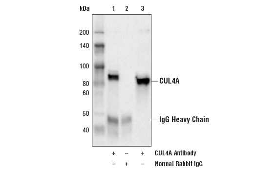 undefined Image 14: Ubiquitin E3 Ligase Complex Antibody Sampler Kit