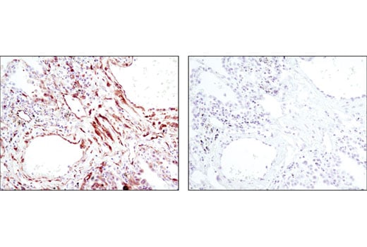 Immunohistochemistry Image 3: Phospho-HSP27 (Ser82) (D1H2F6) XP<sup>®</sup> Rabbit mAb (BSA and Azide Free)