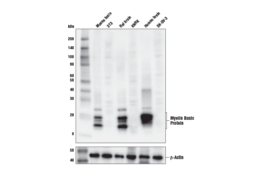 undefined Image 8: Demyelinating Disease Targets Antibody Sampler Kit