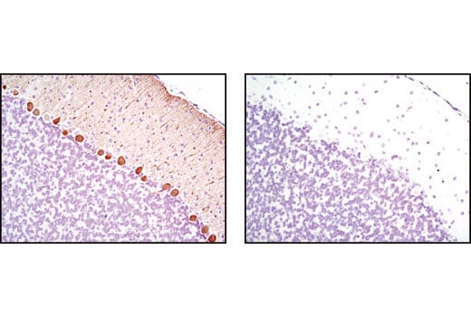 Immunohistochemistry Image 1: Calbindin (C26D12) Rabbit mAb