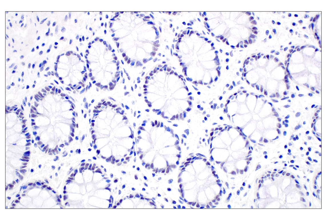 Immunohistochemistry Image 6: MDM2 (F7W7X) Rabbit mAb