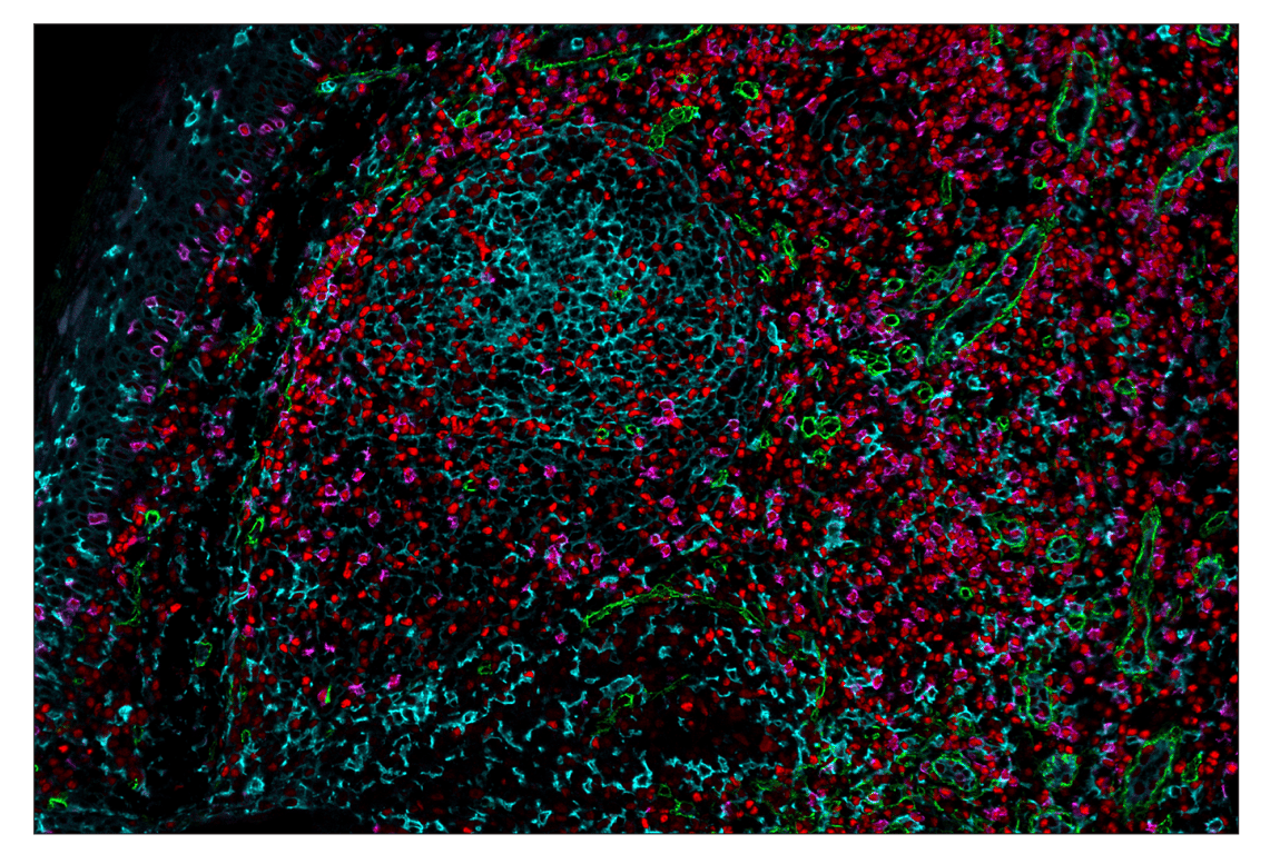 Immunohistochemistry Image 1: CD14 (D7A2T) & CO-0085-488 SignalStar<sup>™</sup> Oligo-Antibody Pair