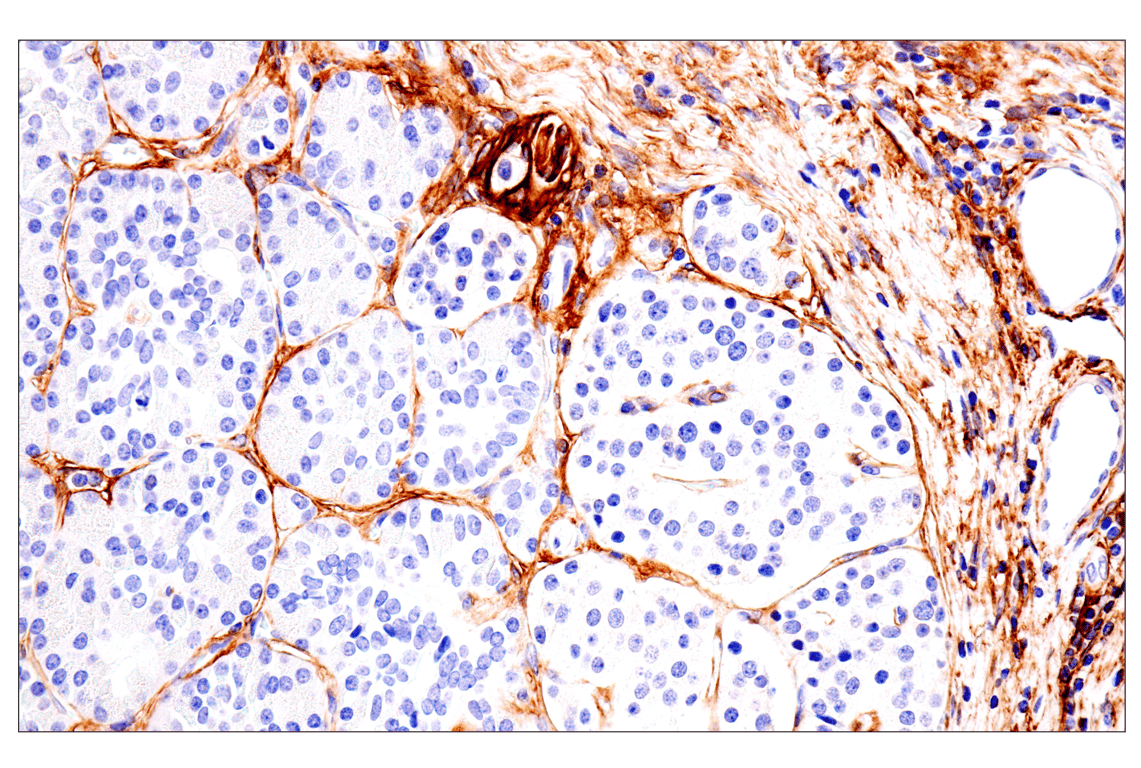 Immunohistochemistry Image 10: p75NTR (E7I3M) Rabbit mAb