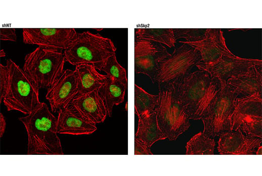 Immunofluorescence Image 1: Skp2 (D3G5) XP<sup>®</sup> Rabbit mAb