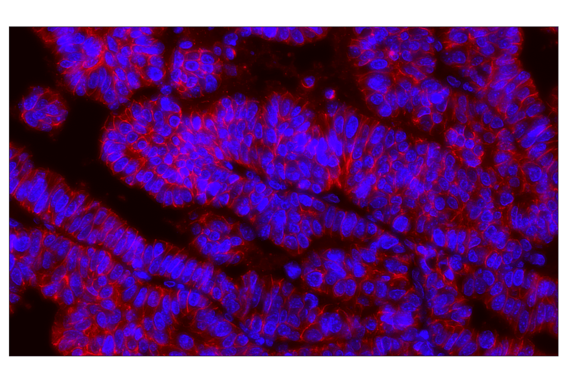 Immunohistochemistry Image 2: E-Cadherin (24E10) Rabbit mAb (Alexa Fluor<sup>®</sup> 647 Conjugate)