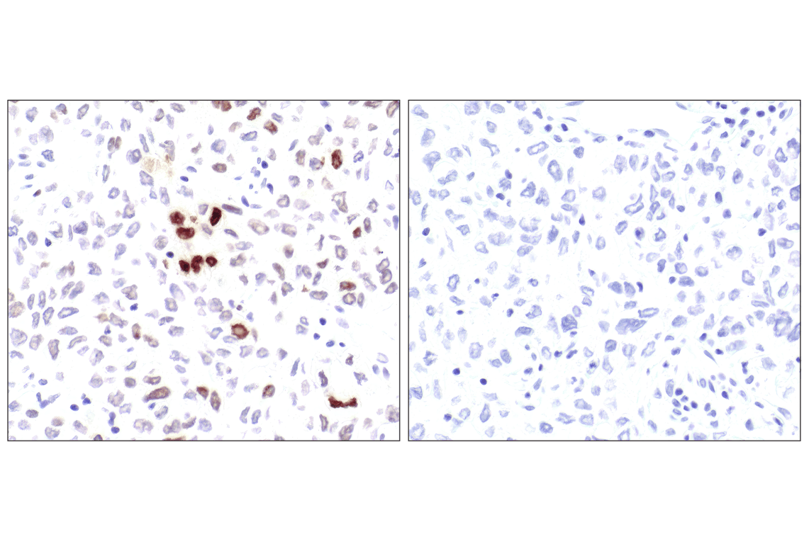 Immunohistochemistry Image 3: Phospho-Histone H2A.X (Ser139) (20E3) Rabbit mAb