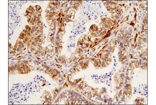 Immunohistochemistry Image 2: β-Arrestin 1 (D7Z3W) XP<sup>®</sup> Rabbit mAb