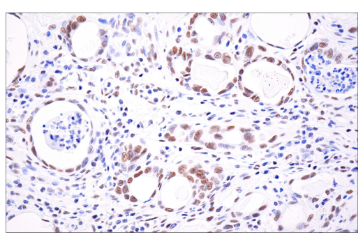 Immunohistochemistry Image 3: ATRX (E5X7O) Rabbit mAb (BSA and Azide Free)