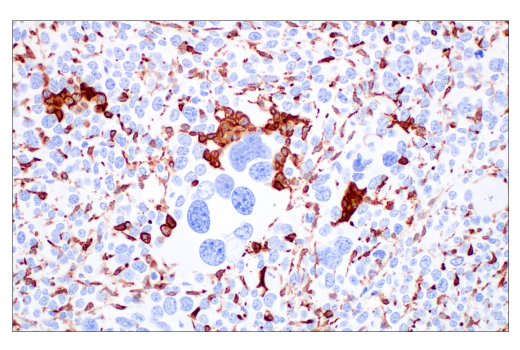 Immunohistochemistry Image 3: CD206/MRC1 (E6T5J) XP<sup>®</sup> Rabbit mAb (BSA and Azide Free)