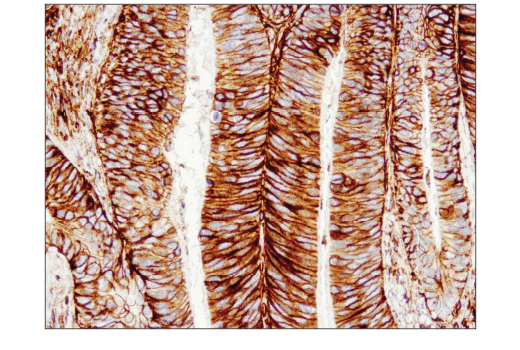 Immunohistochemistry Image 1: CD44 (E7K2Y) XP<sup>®</sup> Rabbit mAb
