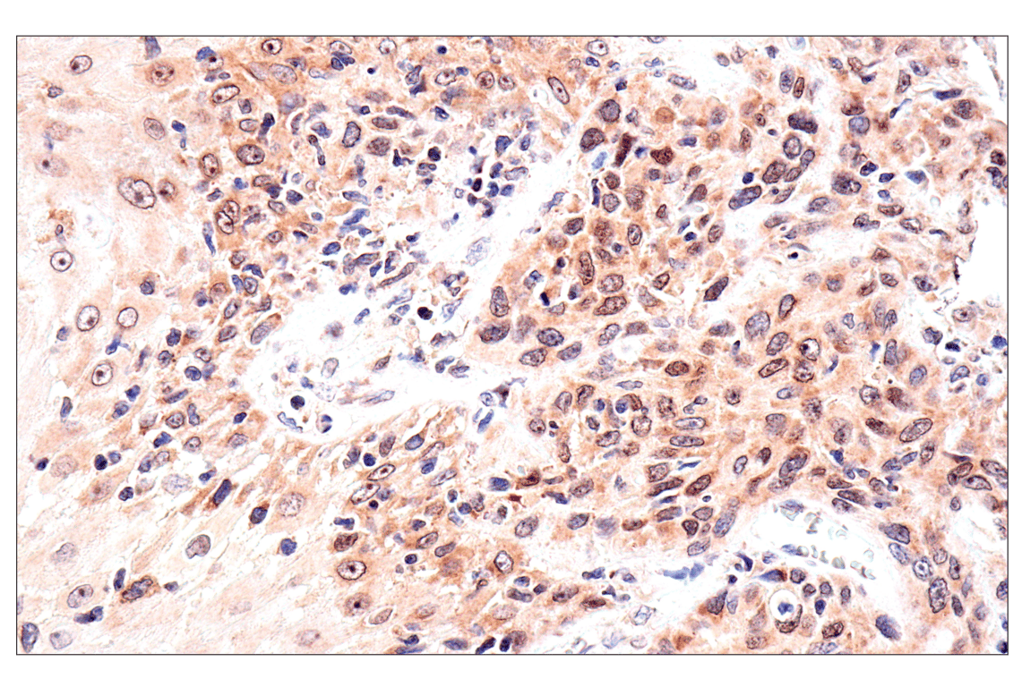 Immunohistochemistry Image 8: ADAR1 p150 Isoform   (E6U1U) Rabbit mAb   (BSA and Azide Free)