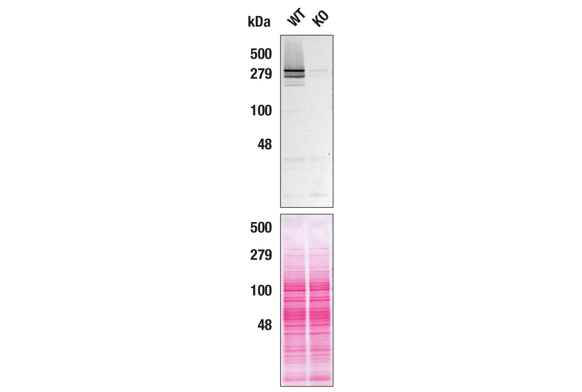 Western Blotting Image 2: Huntingtin (D7F7) XP<sup>®</sup> Rabbit mAb